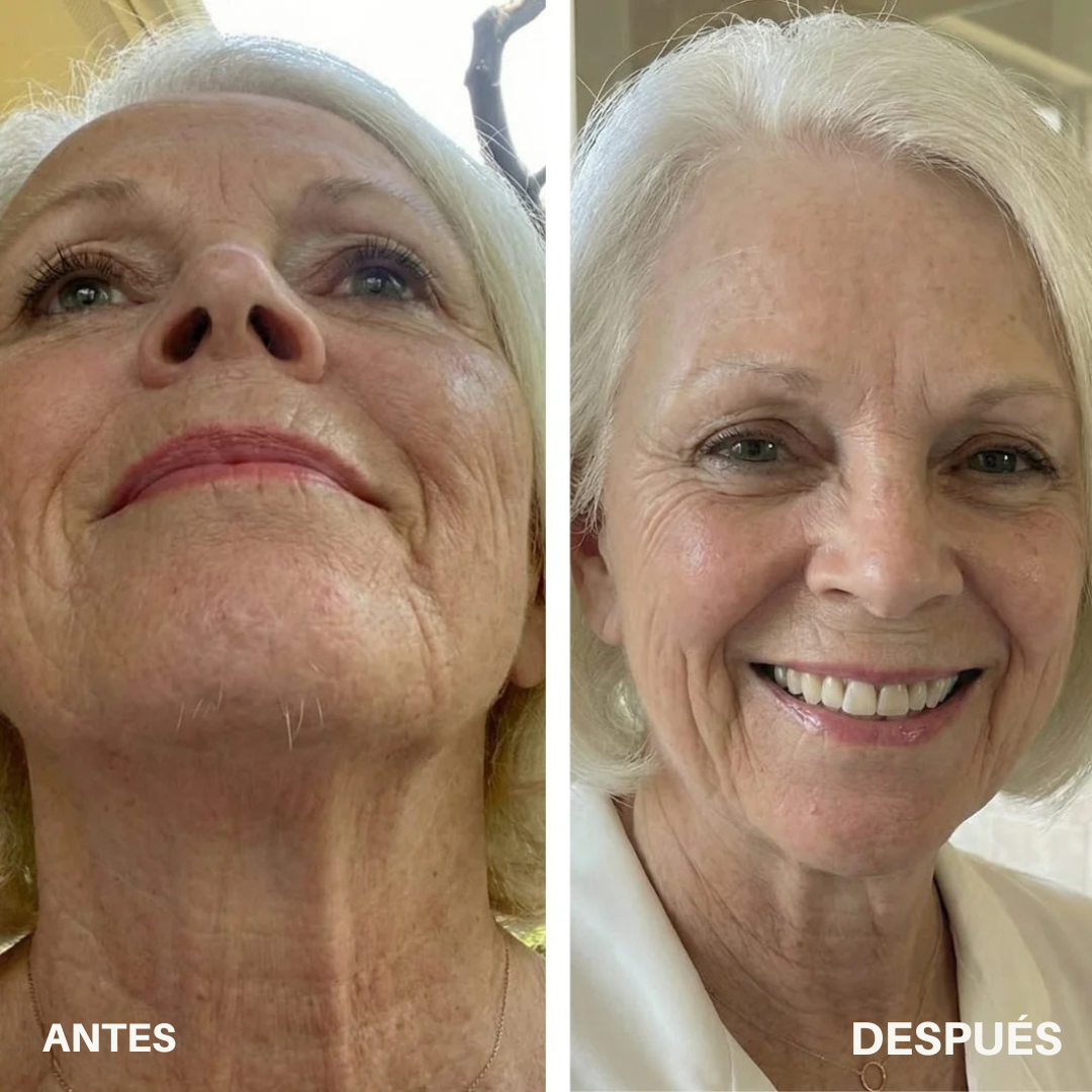 Musta Serum — Aceite Inhibidor de Vello · Cyperus Rotundus 30ml