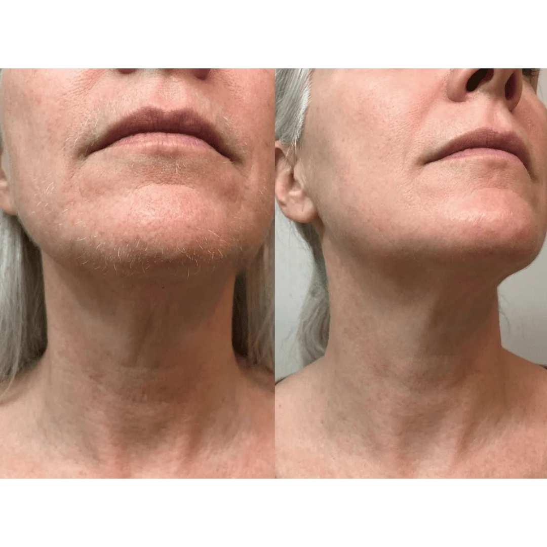 Especialmente efectivo en SOP