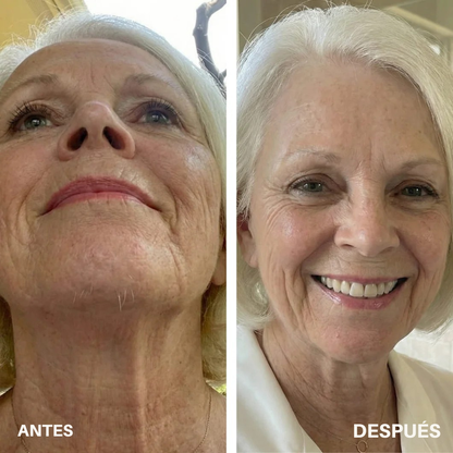 Musta Serum — Aceite Inhibidor de Vello · Cyperus Rotundus 30ml